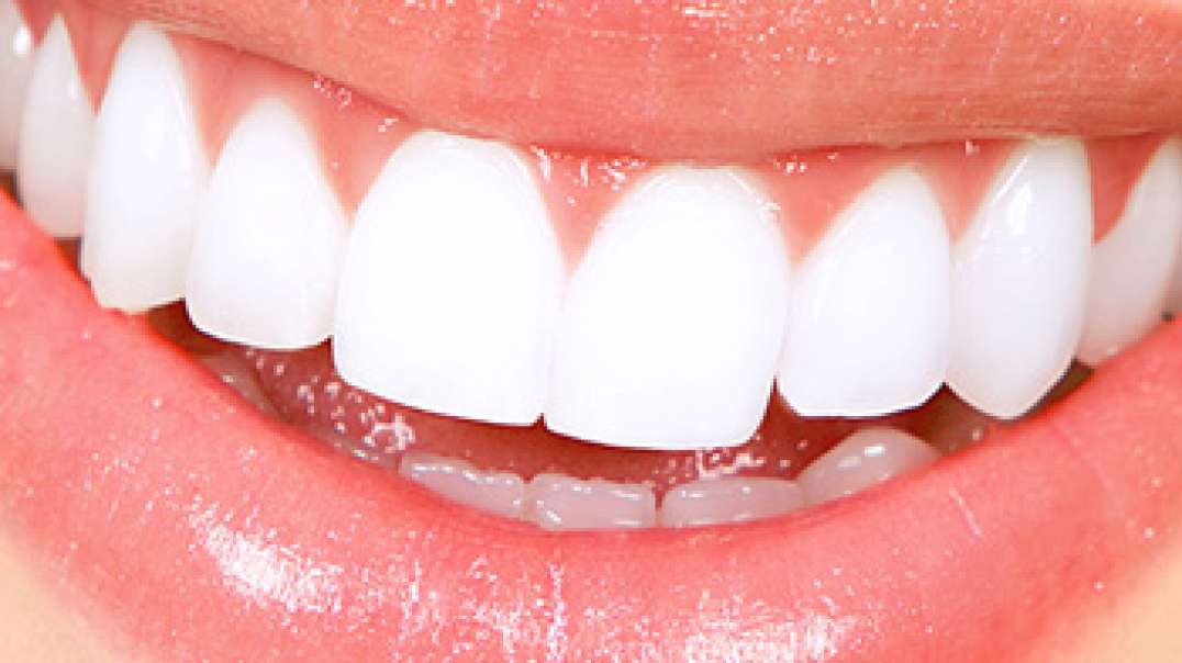 DB Dental Care : Smile Makeover in Miami, FL