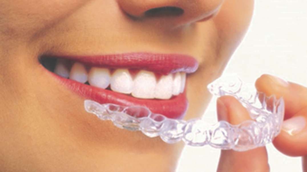 Mancia Orthodontics : #1 Clear Braces in Miami, FL | 305-559-5571